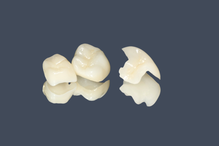 ハイブリッドセラミックス（詰め物・クラウン）