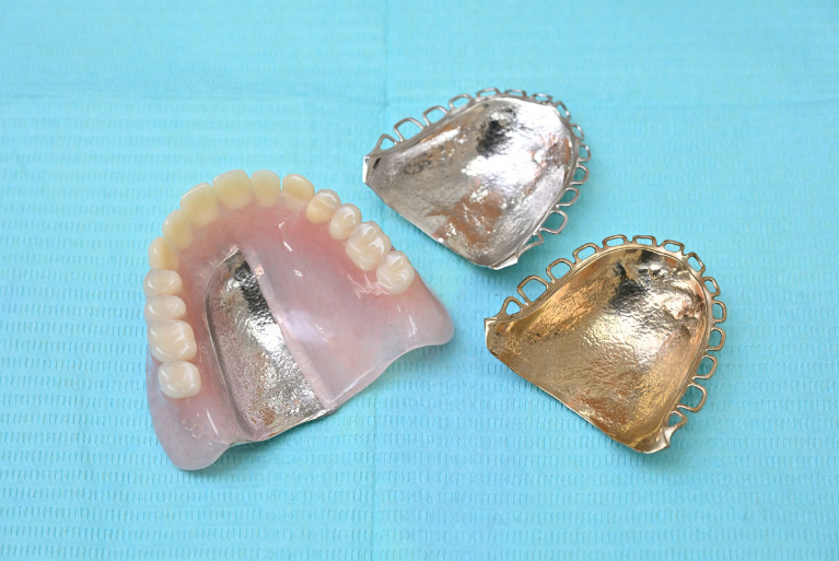 金属床入れ歯