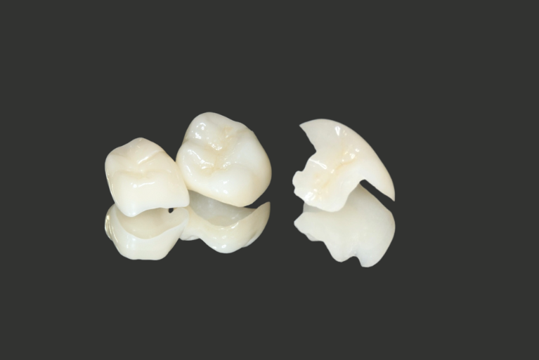 オールセラミックス（詰め物・クラウン）